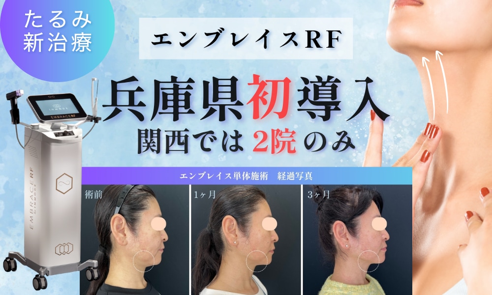 兵庫県内でエンブレイスRFを取り扱っているのは「姫路院だけ」