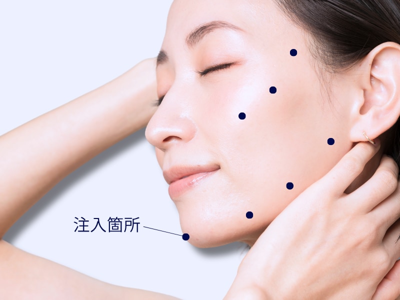 注入箇所MAP