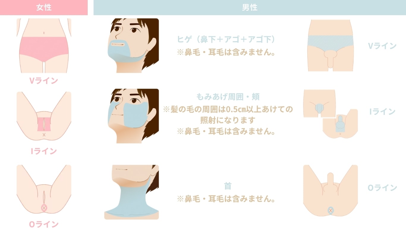 対象部位（VIO・男性フェイス・首）の料金一覧