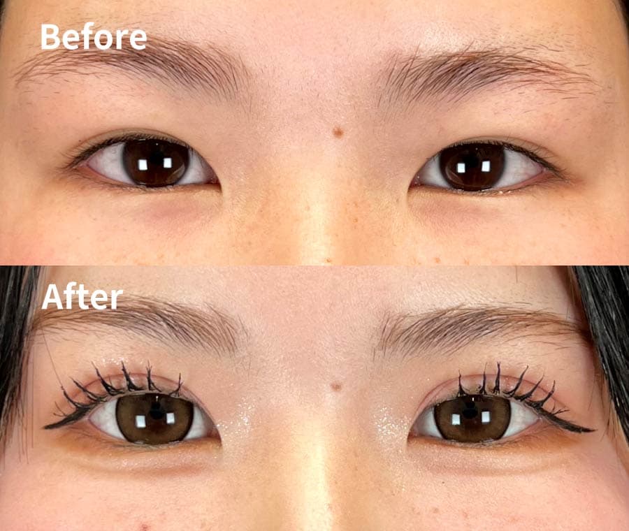 10代女性の症例