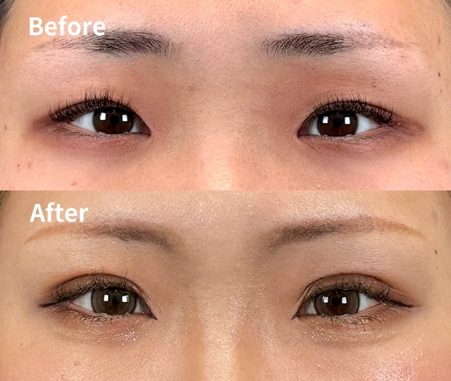 20代女性の症例