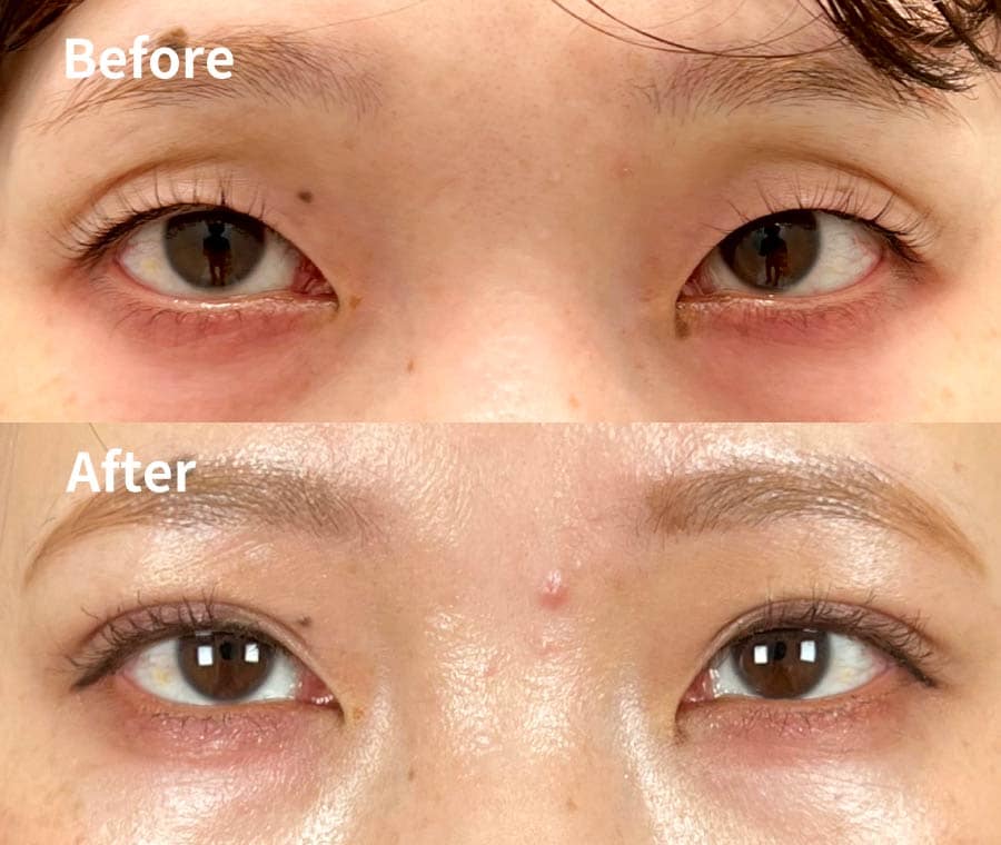 30代女性の症例