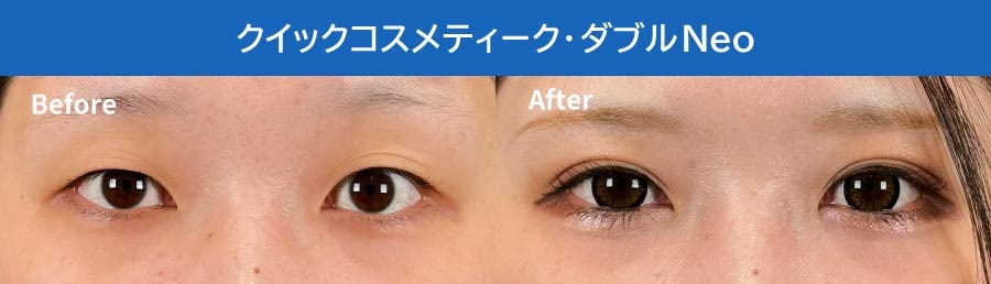 クイックコスメティーク・ダブルNeo