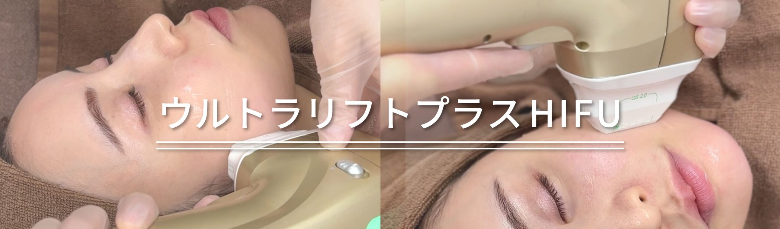 医療ハイフ（HIFU）で期待できる効果