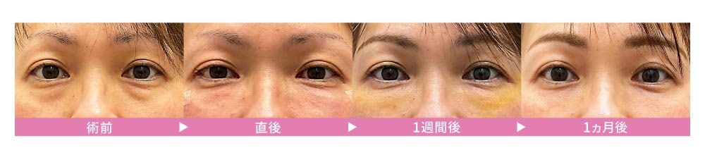 3.最小限のダウンタイム