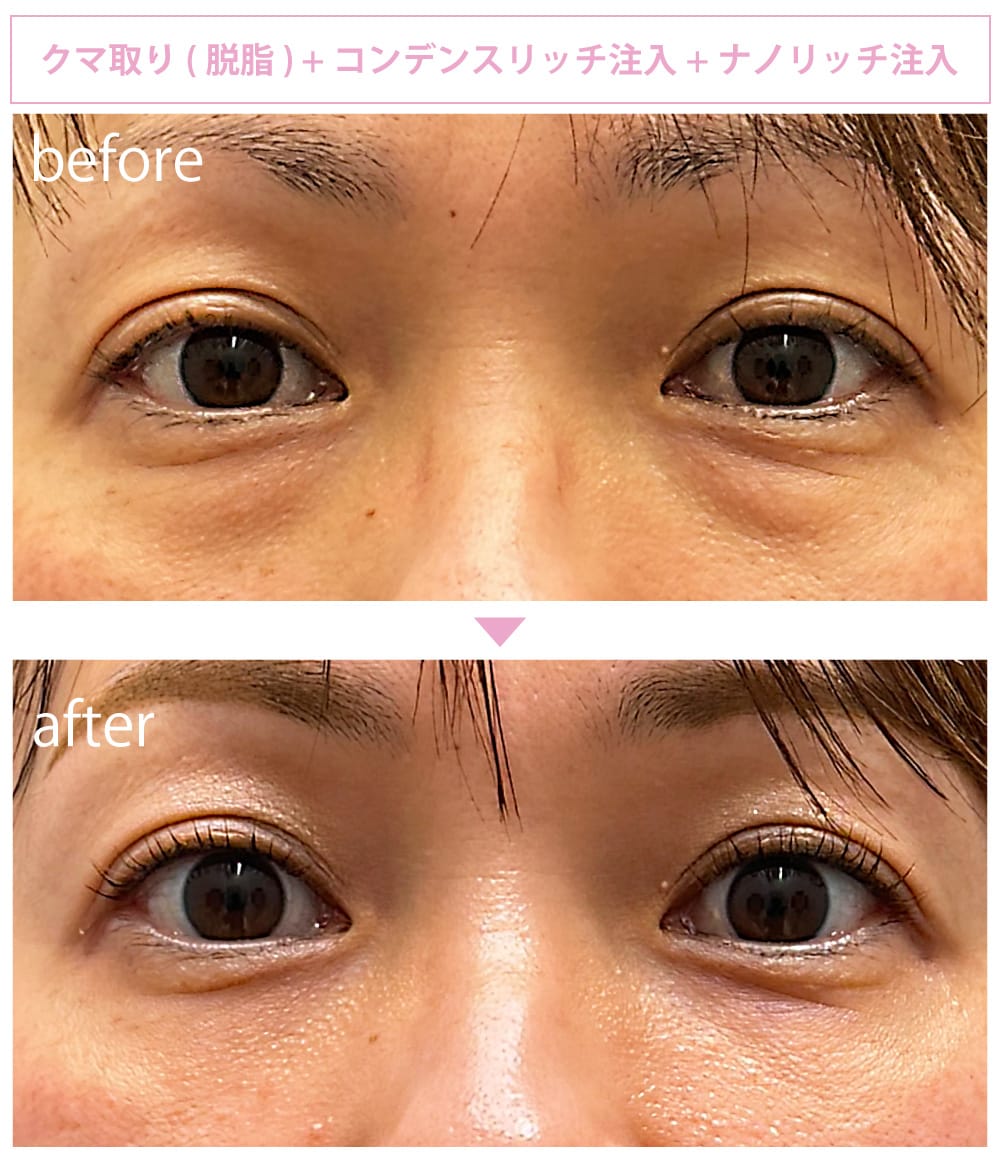 50代女性の症例