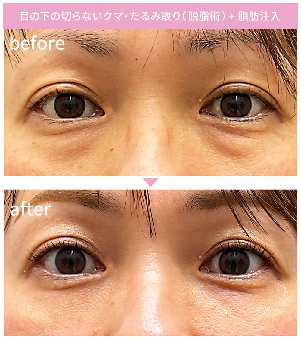 5.圧倒的な仕上がり