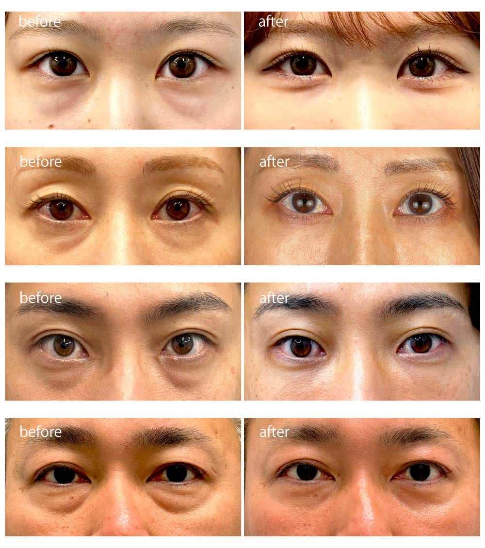 まずは田原医師の症例をご覧ください！