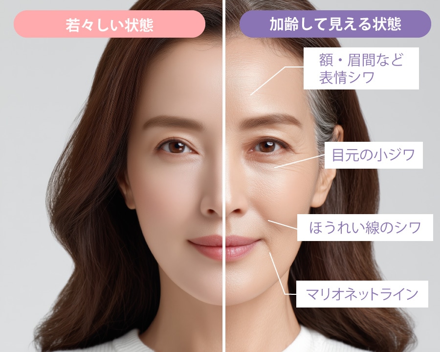 部位や状態によって最適なシワ治療をご提案