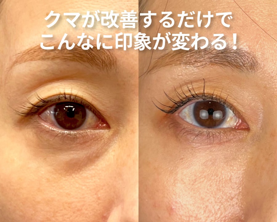 こんなに印象が変わります