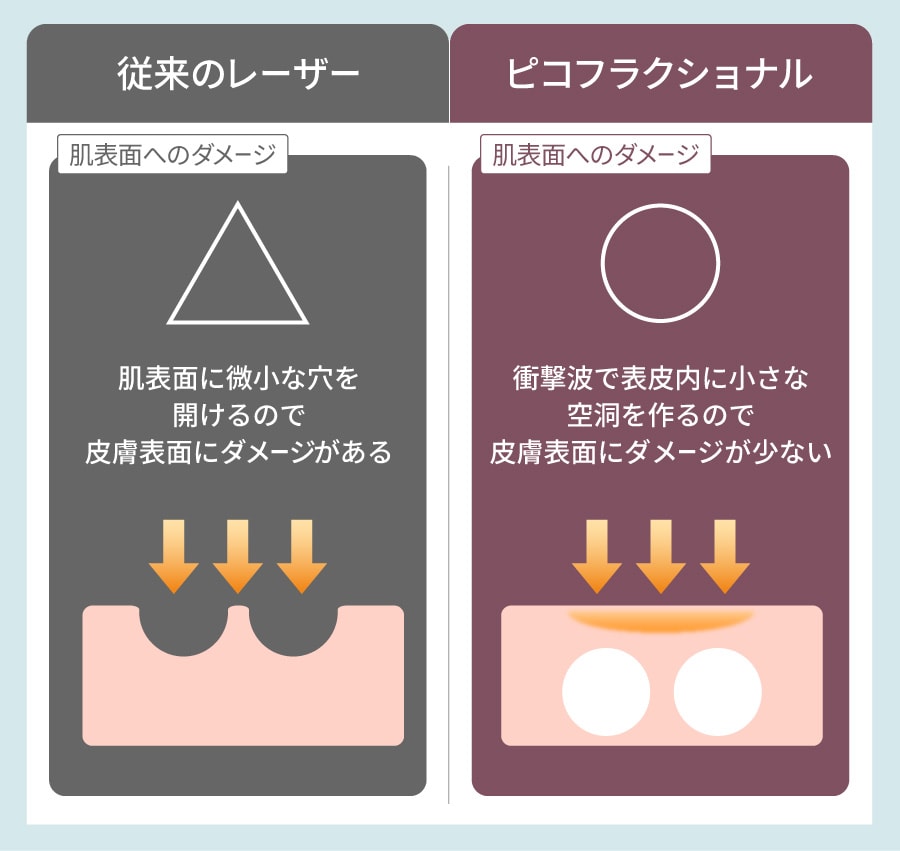 従来のレーザーとピコフラクショナルの違い
