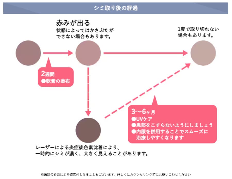 シミ取りの経過