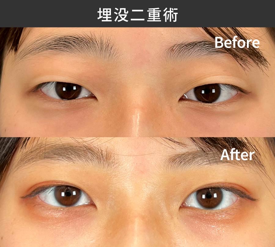 整形した感のない“自然な仕上がり”