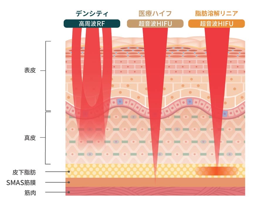アプローチする層が違う