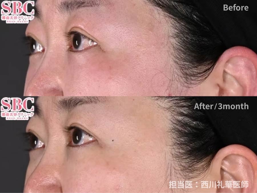 目元がスッキリとして小じわも改善！