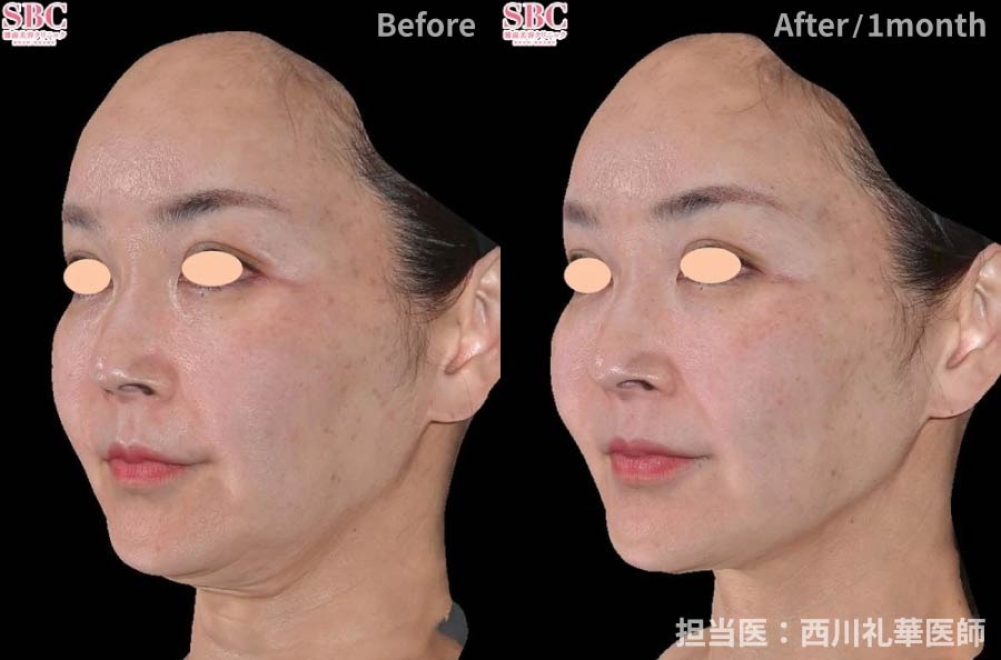 併用すると相乗効果アップ