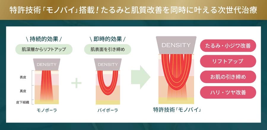 独自のモノバイ技術搭載