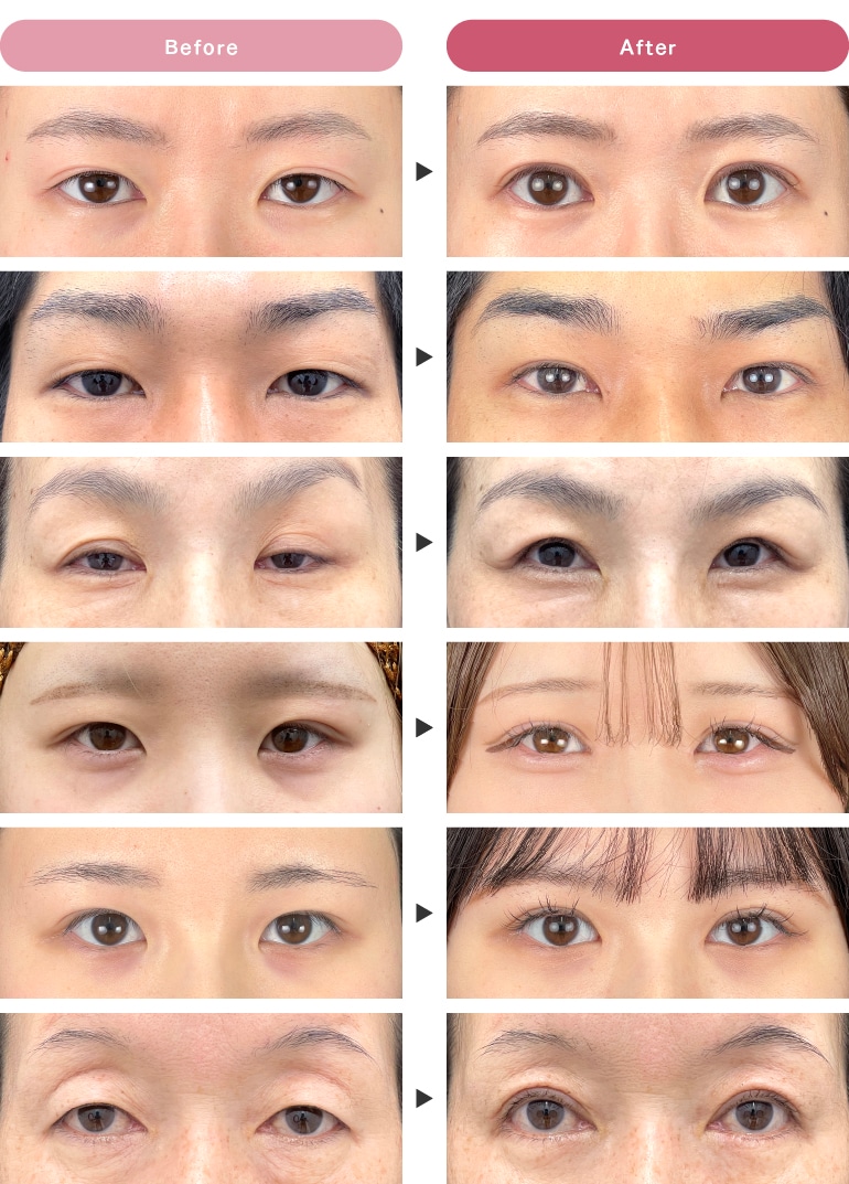 脳がだまされている？| article | TEREMIN | TDK, image size:770x1073