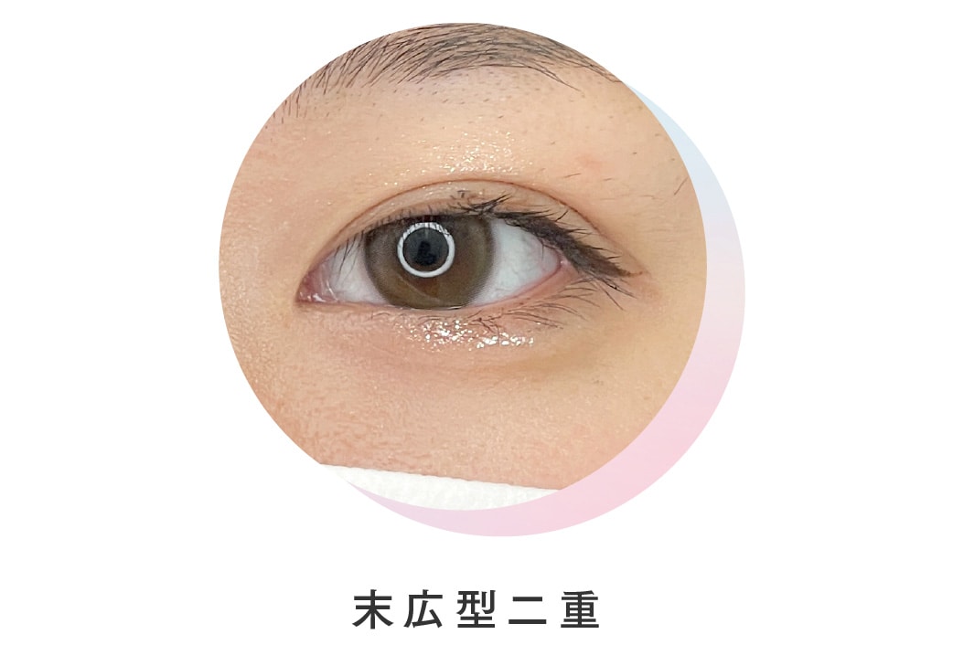 末広型二重