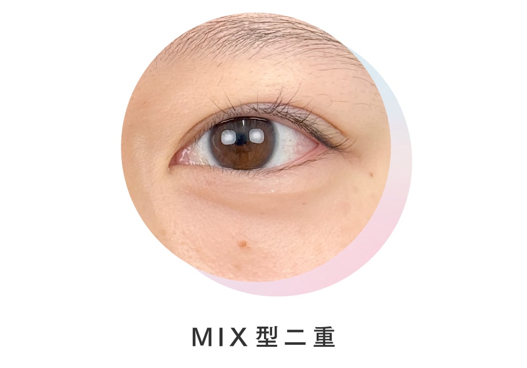 MIX型二重