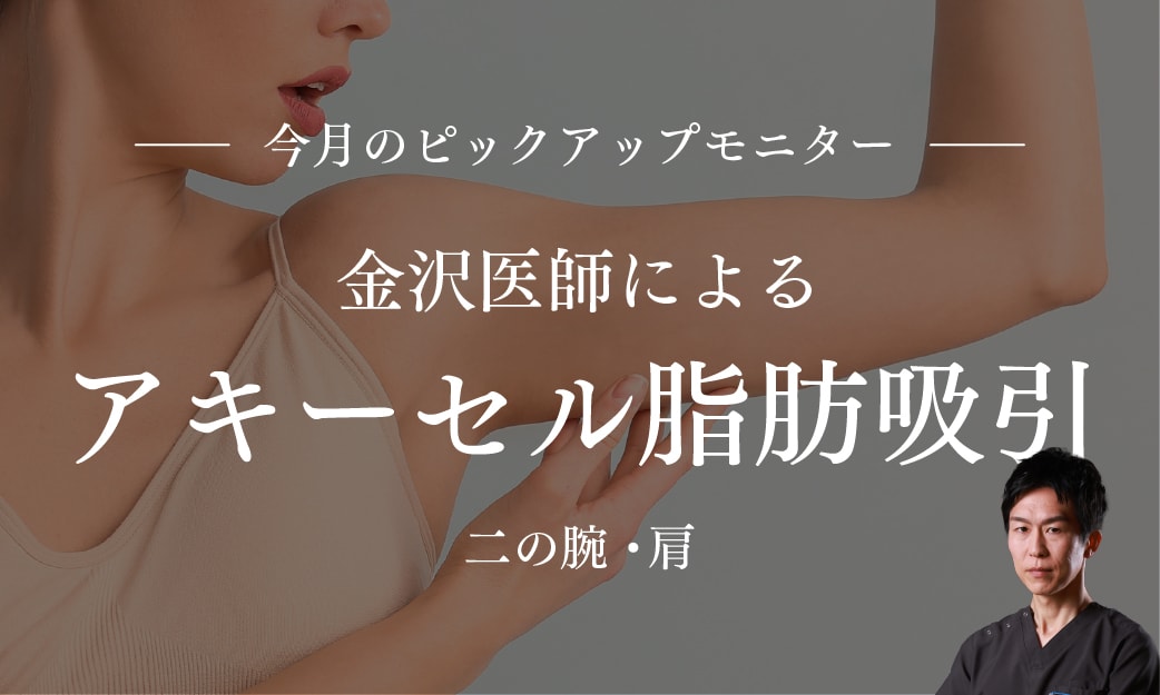 金沢先生による脂肪吸引モニター