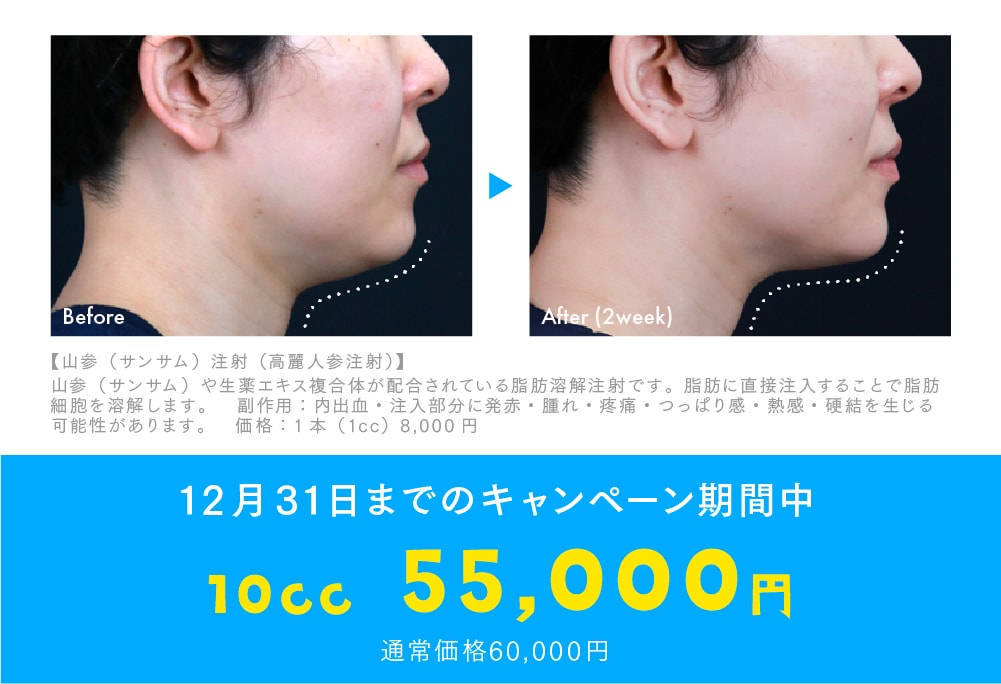 【12/31までがお得！】冬の大特価キャンペーン開催中