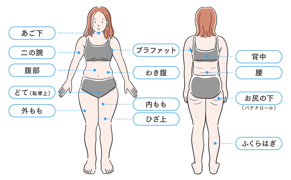 適応部位はこちら