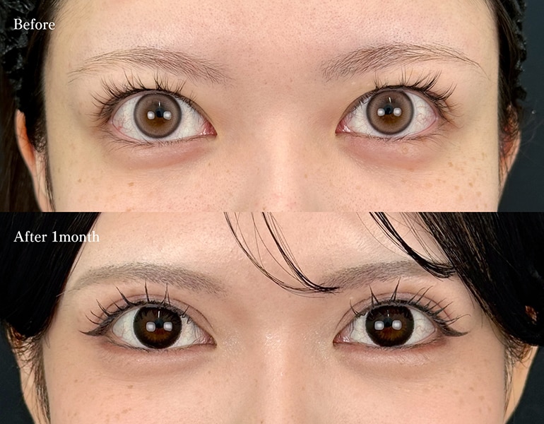 クイックコスメティーク・トリプルNEO