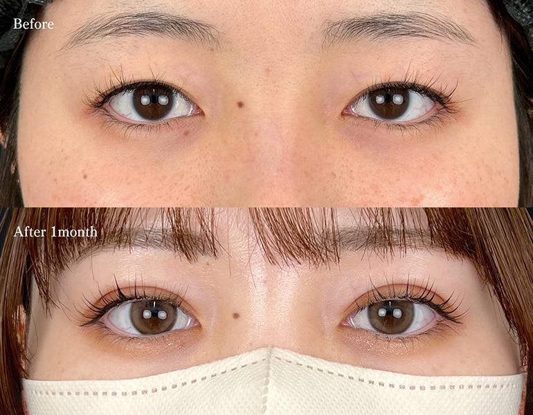 クイックコスメティーク・ダブルNEO