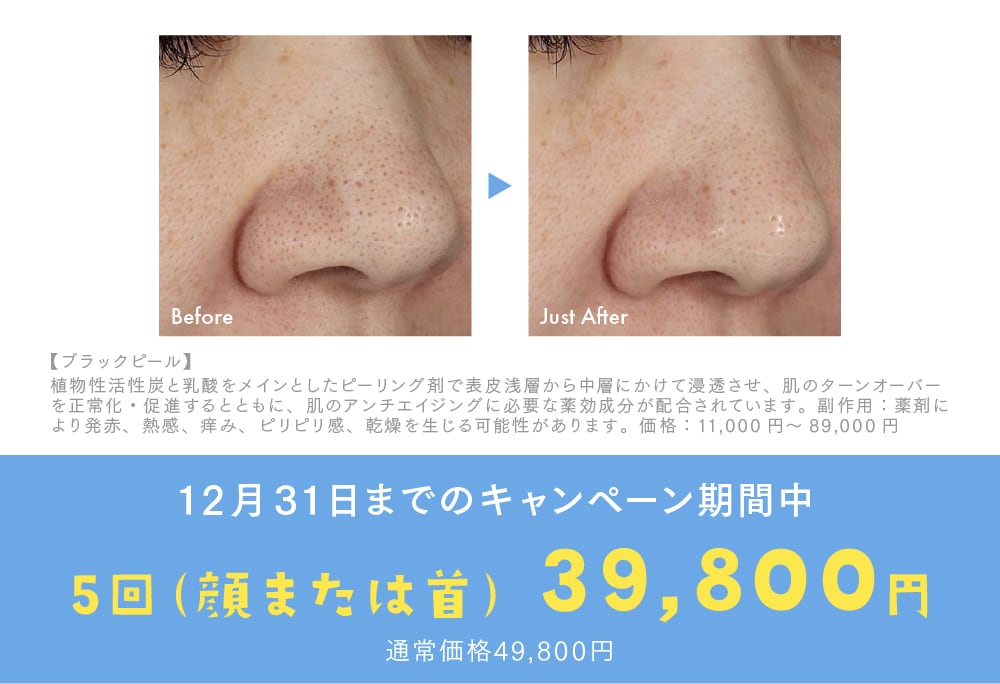 【12/31までがお得！】冬の大特価キャンペーン開催中