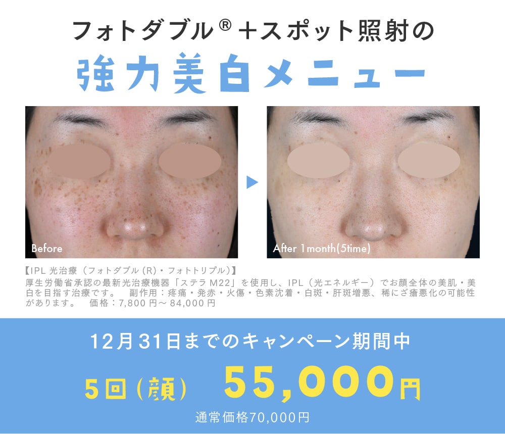 フォトトリプル 5回コース