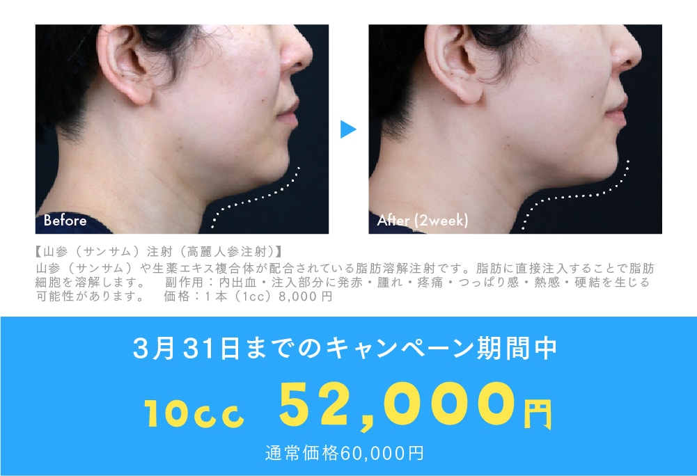 【3/31までがお得！】春の大特価キャンペーン開催中