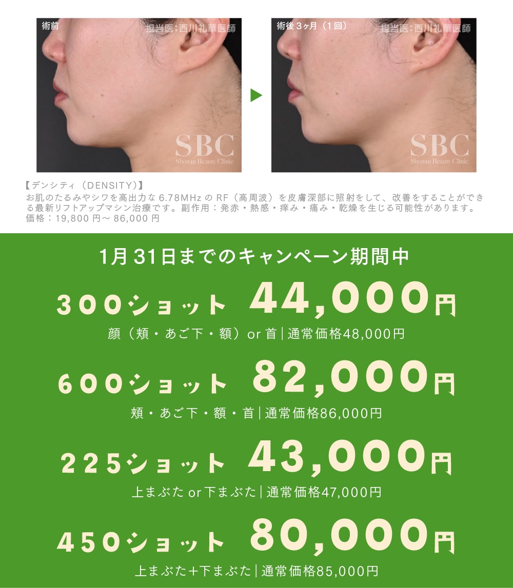 【1/31までがお得！】冬の大特価キャンペーン開催中