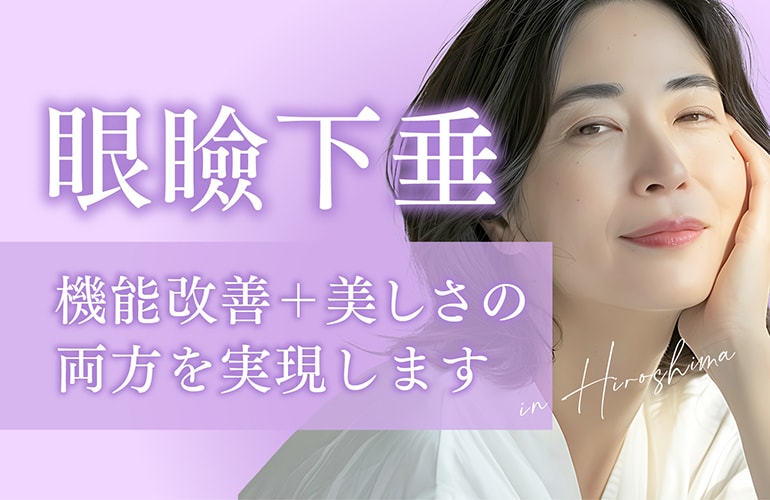 【広島】眼瞼下垂治療の名医|目の開きが悪い方へ「美しさ」と「機能」を両立する眼瞼下垂治療