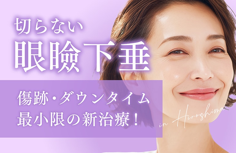 【広島】「切らない眼瞼下垂」をするなら湘南美容クリニック広島院|切開なしで目の開きを改善する画期的な治療をついに導入!