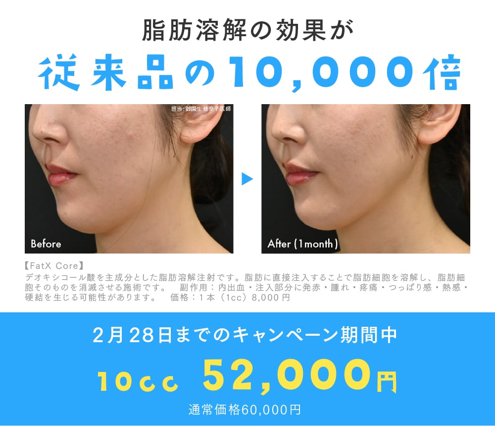 脂肪溶解注射FatX Core10cc