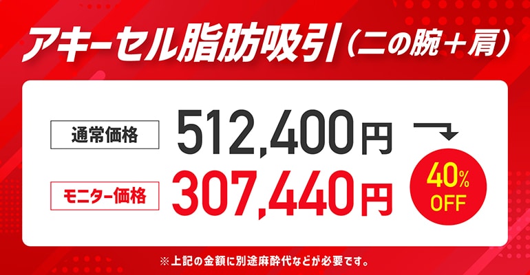 ③アキーセル脂肪吸引