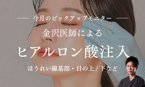 金沢先生によるヒアルロン酸注入モニター