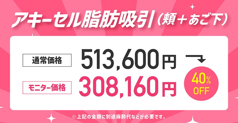 ③アキーセル脂肪吸引