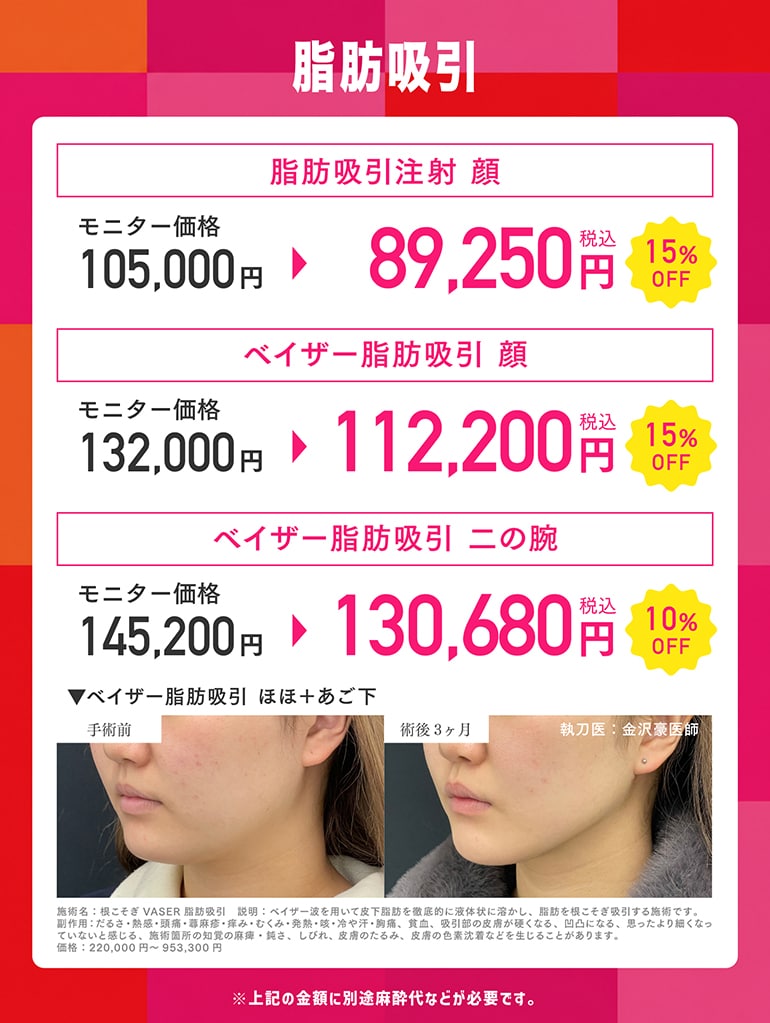 ③脂肪吸引キャンペーン