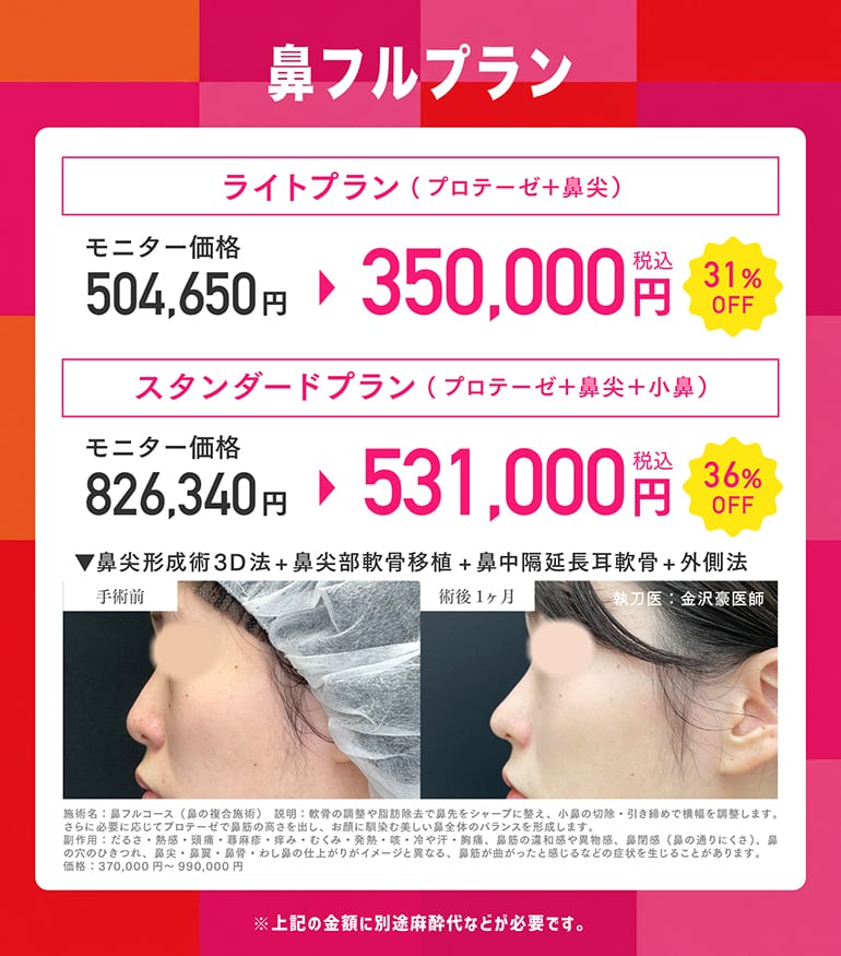 ④鼻フルキャンペーン