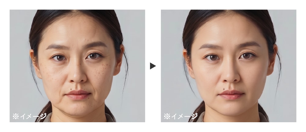 医療エイジングケアによる変化のイメージ