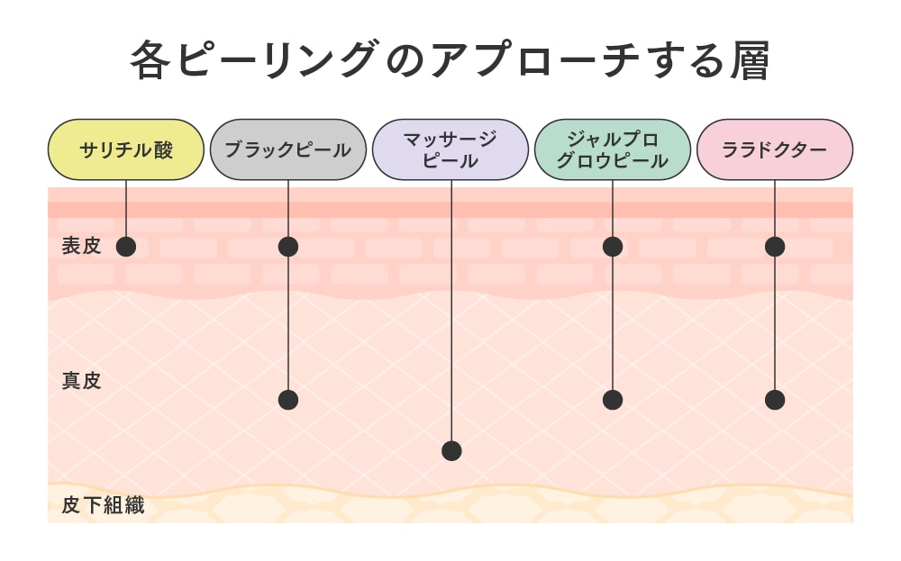 ピーリング5種の比較表