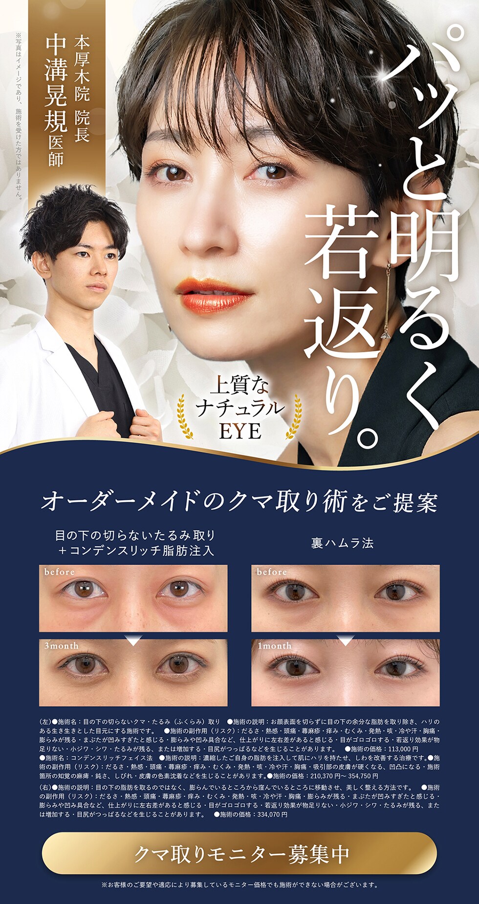 パッと明るく若返り。　上質なナチュラルEYE　お得なモニター様募集中