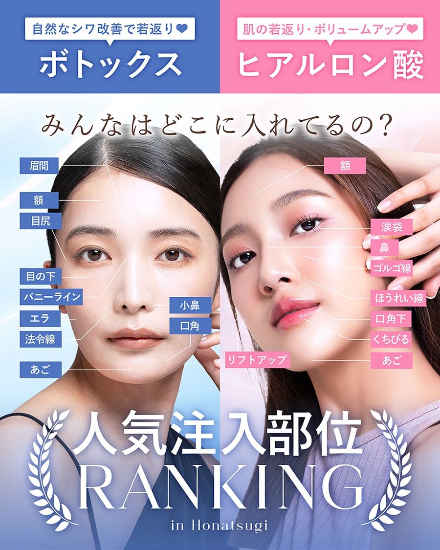 ボトックス&ヒアルロン酸注射