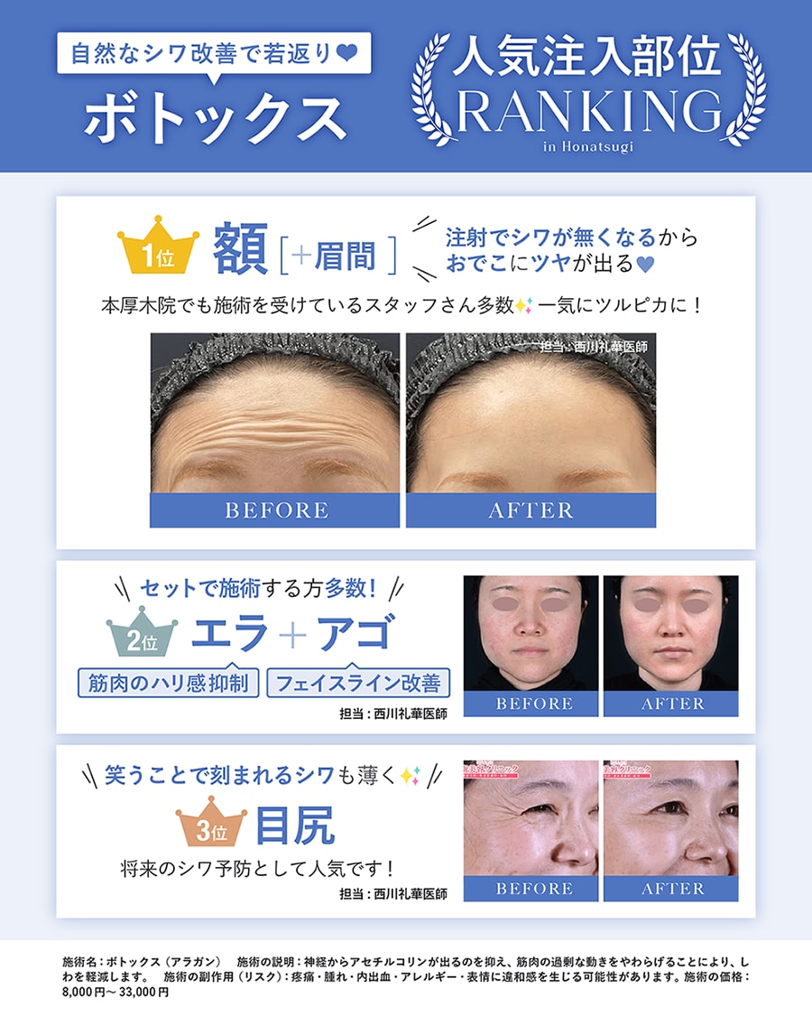 ボトックス
