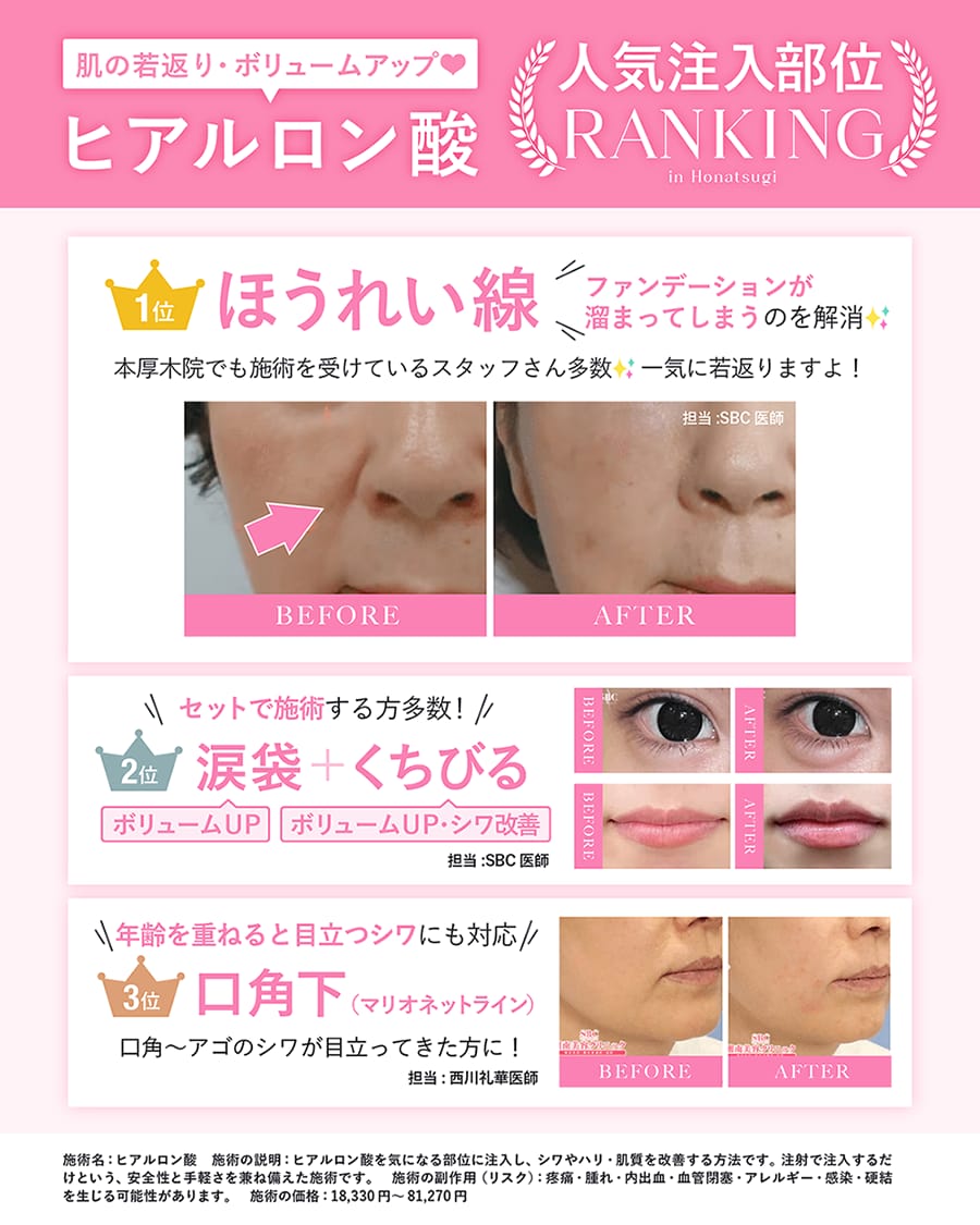ヒアルロン酸