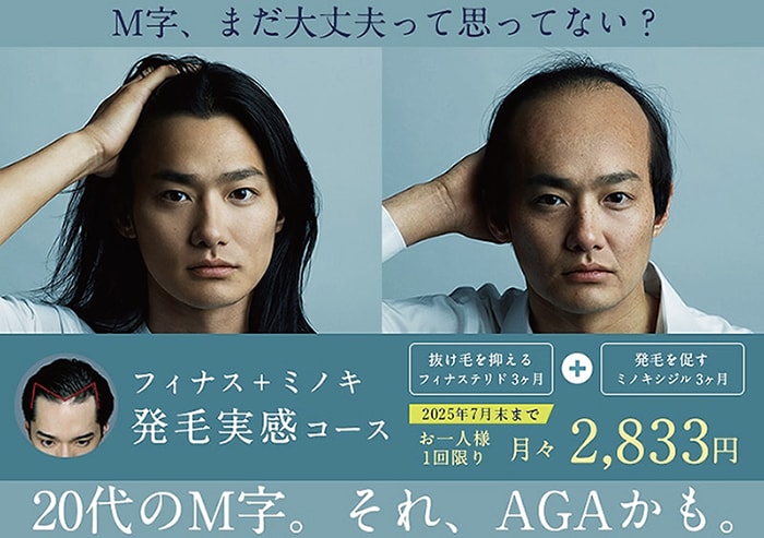 AGAの初回キャンペーン実施中！