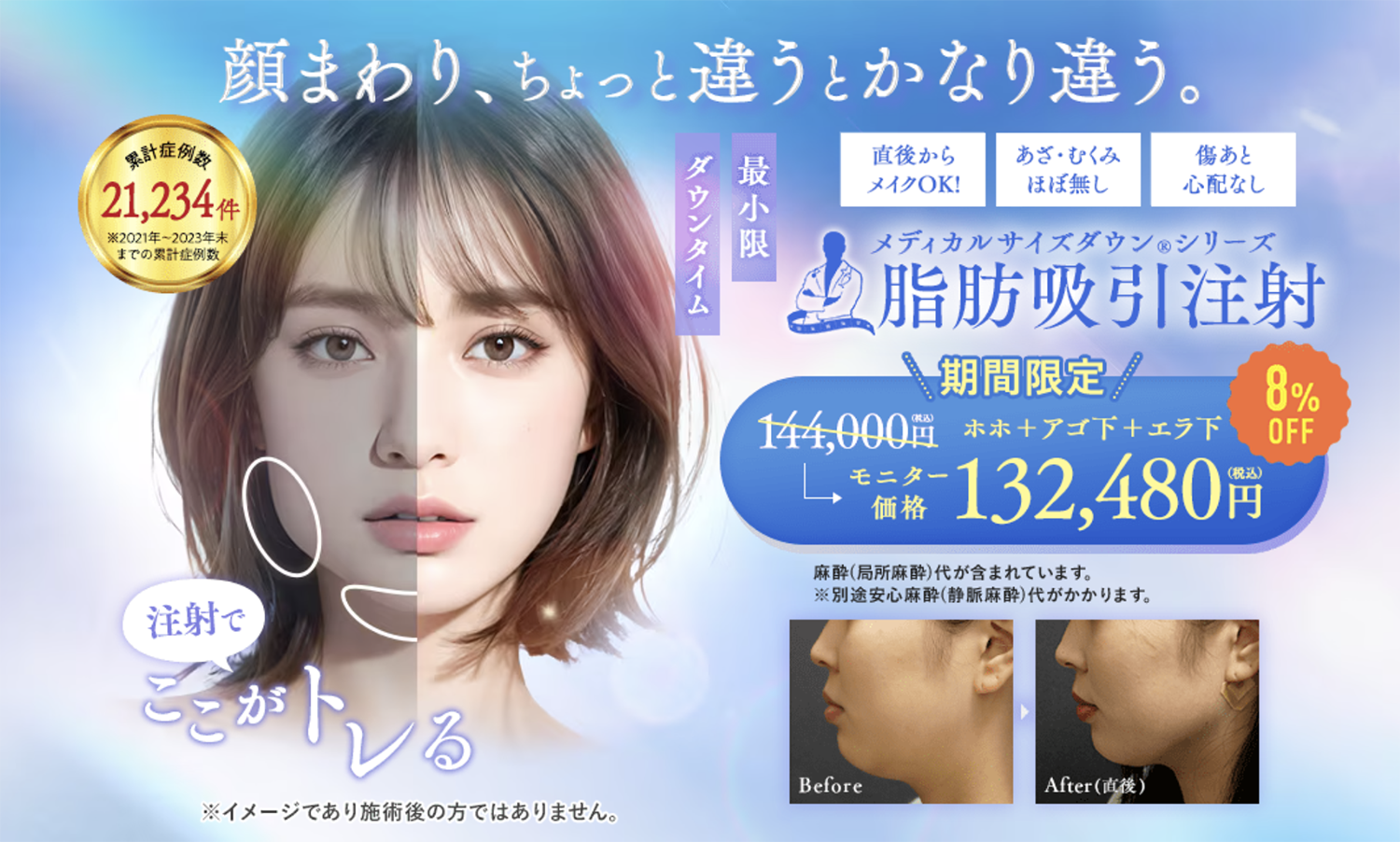 脂肪吸引注射って?