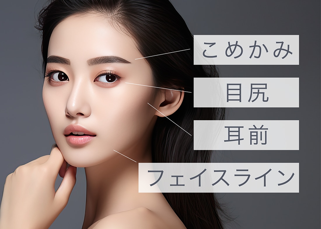リフトアップ効果も期待できる注入箇所